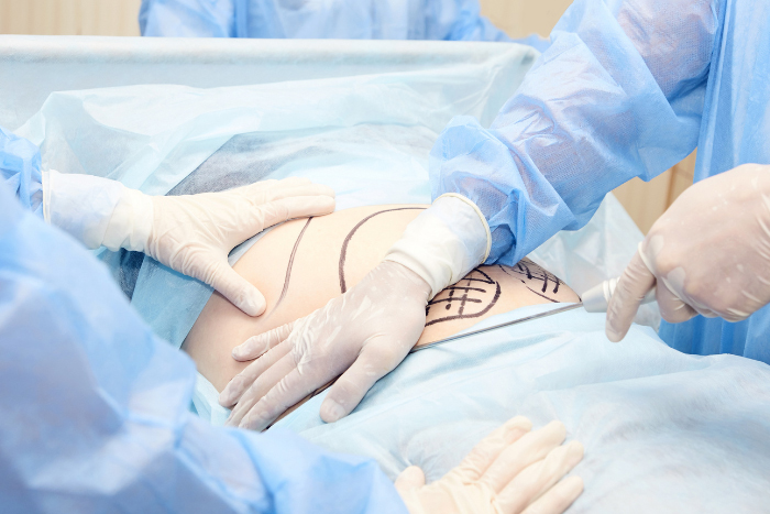 ฉีดไขมันหน้าเด็ก