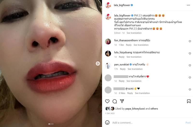 ลาล่า อาร์สยาม, ฝุ่น PM2.5