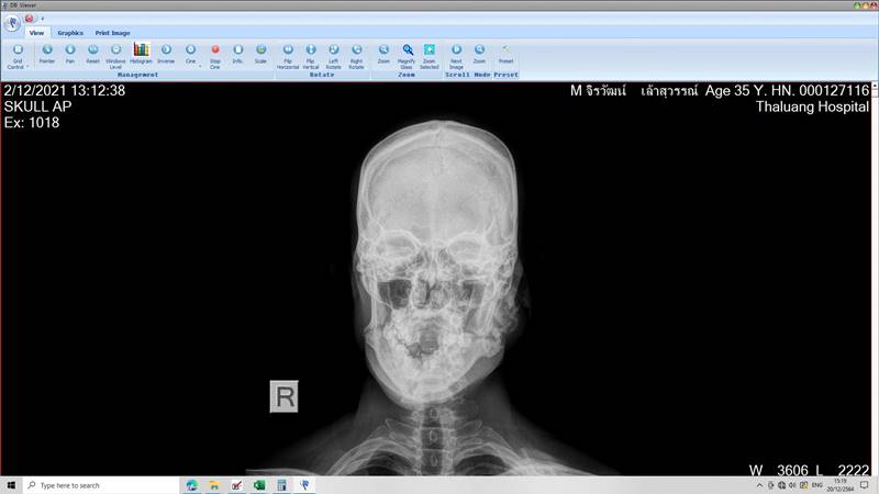 น้องฟ้า ถูกทำร้าย