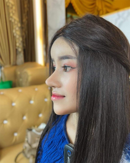 หนูรัตน์ ศัลยกรรม