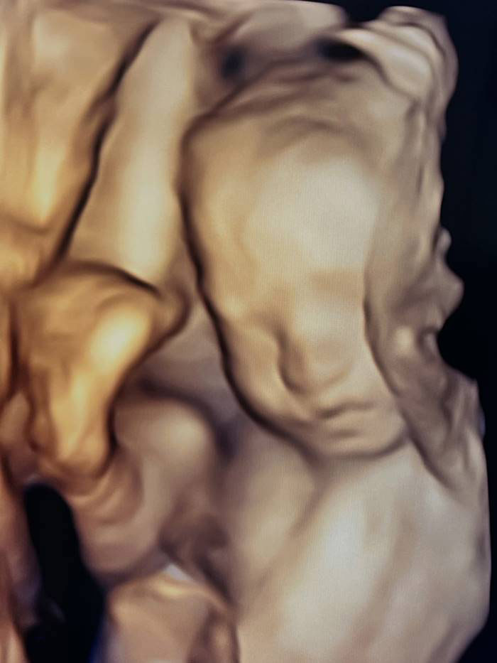  เจมส์ เรืองศักดิ์