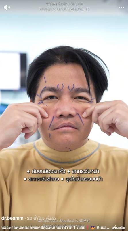  ดีเจพีเค ปิยะวัฒน์ ศัลยกรรมอัปหน้าใหม่