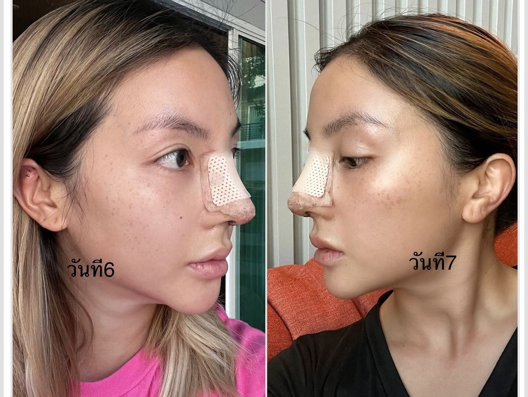 ฮารุ สุประกอบ