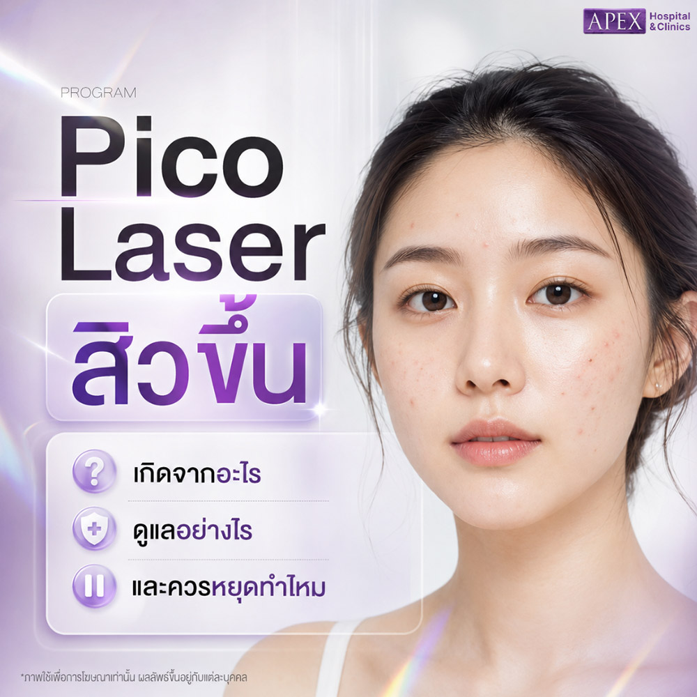 Pico Laser สิวขึ้น