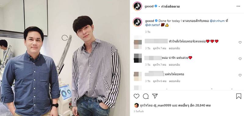 ก็อต อิทธิพัทธ์ ลบรอยสัก 