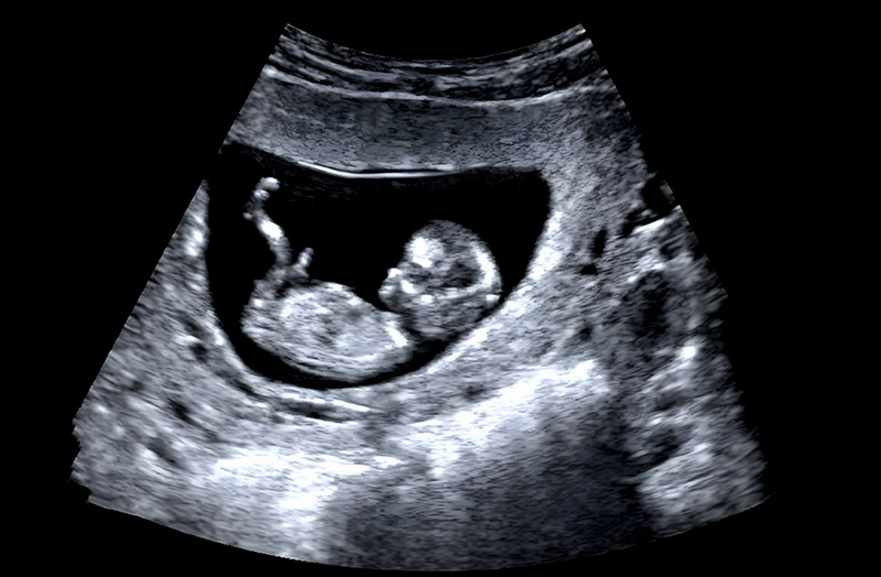 ลูกดิ้นแค่ไหนถึงเรียกว่าปกติ