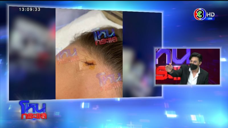 ไผ่ ลิกค์ ดิว อริสรา ถูกทำร้าย