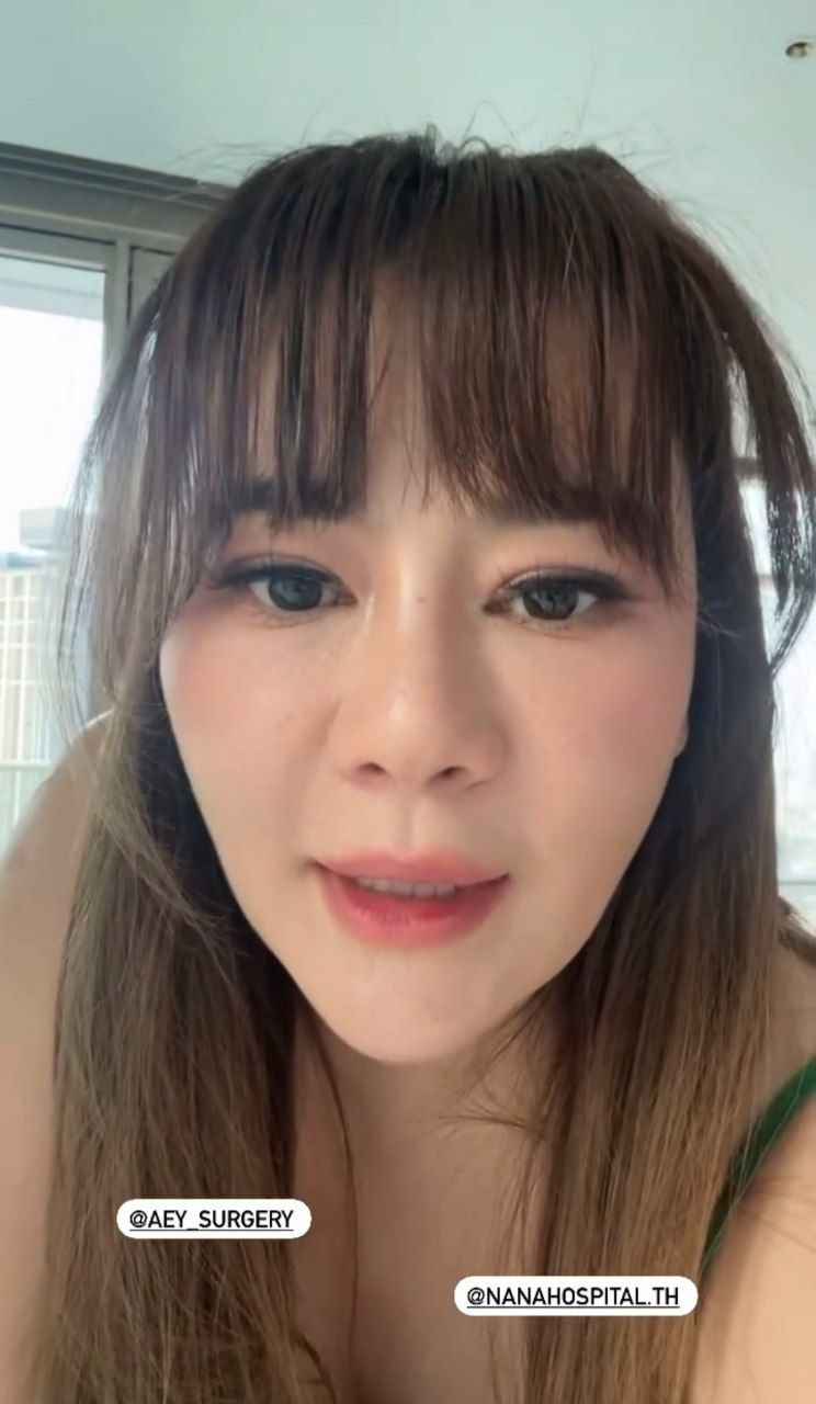 โอ๋ ภัคจีรา ศัลยกรรม