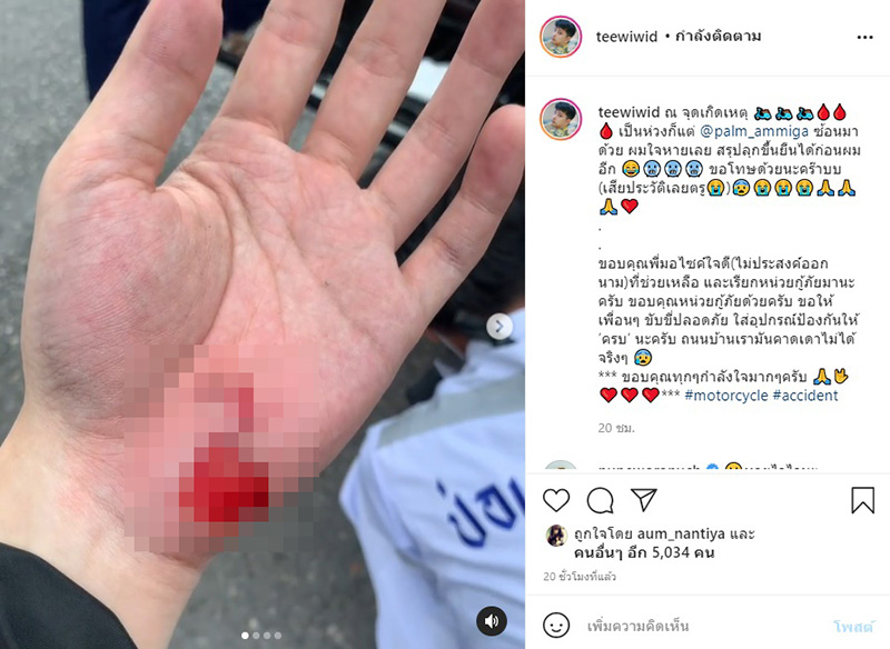 ตี๋ เอเอฟ 