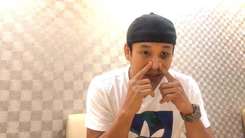 เอ็กซ์ ธิตินันท์