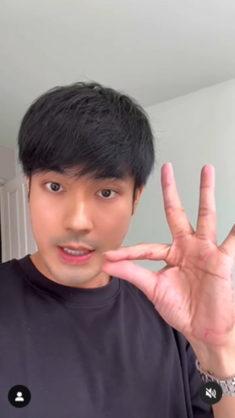 หน่อง ธนา, โฟร์ ศกลรัตน์