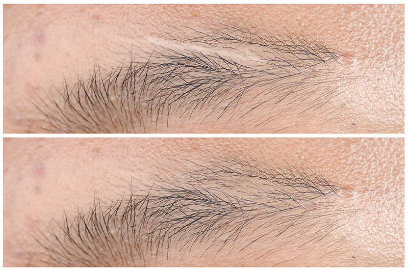 ผู้ชายคิ้วบาง