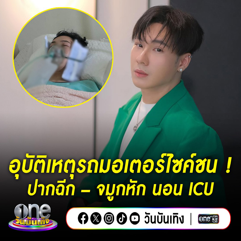ตั้ม วราวุธ ขี่มอเตอร์ไซค์ชน เจ็บหนัก
