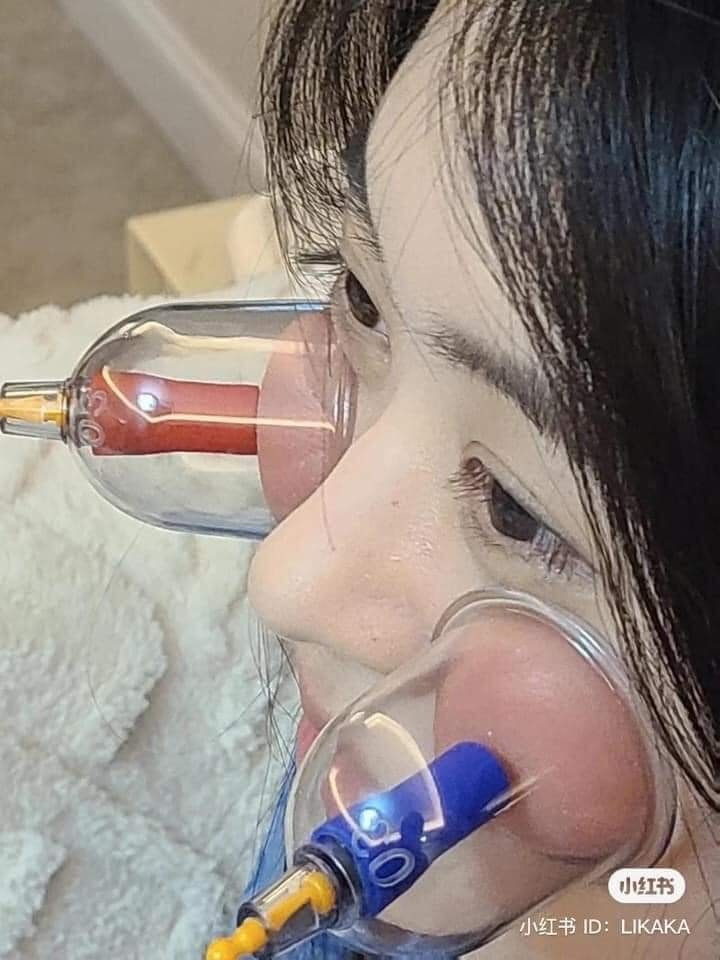 แก้มอมชมพู