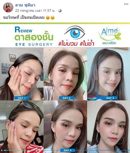 อาม ชุติมา