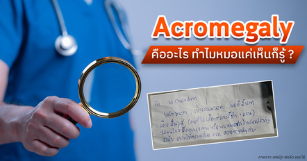 Acromegaly คืออะไร เช็ก 8 อาการต้องสงสัย จากข่าวนักดนตรีป่วย !